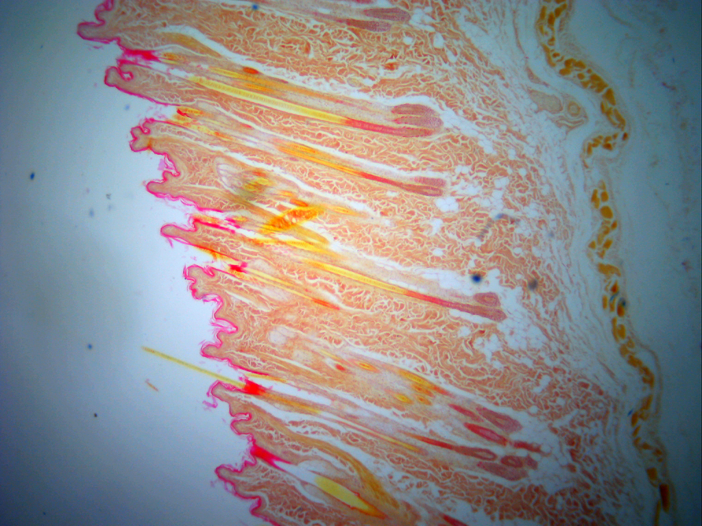 Epidermis con bulbos pilosos (40 aumentos)